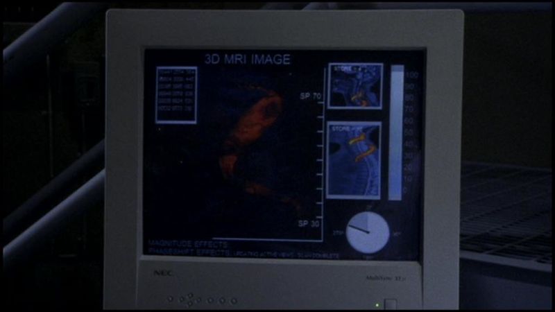 Fichier:IRM de Charles Kawalsky.jpg